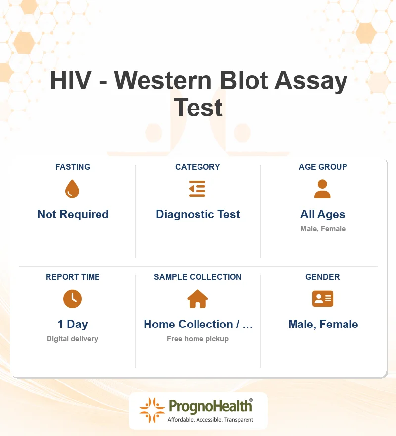HIV - Western Blot Assay Test