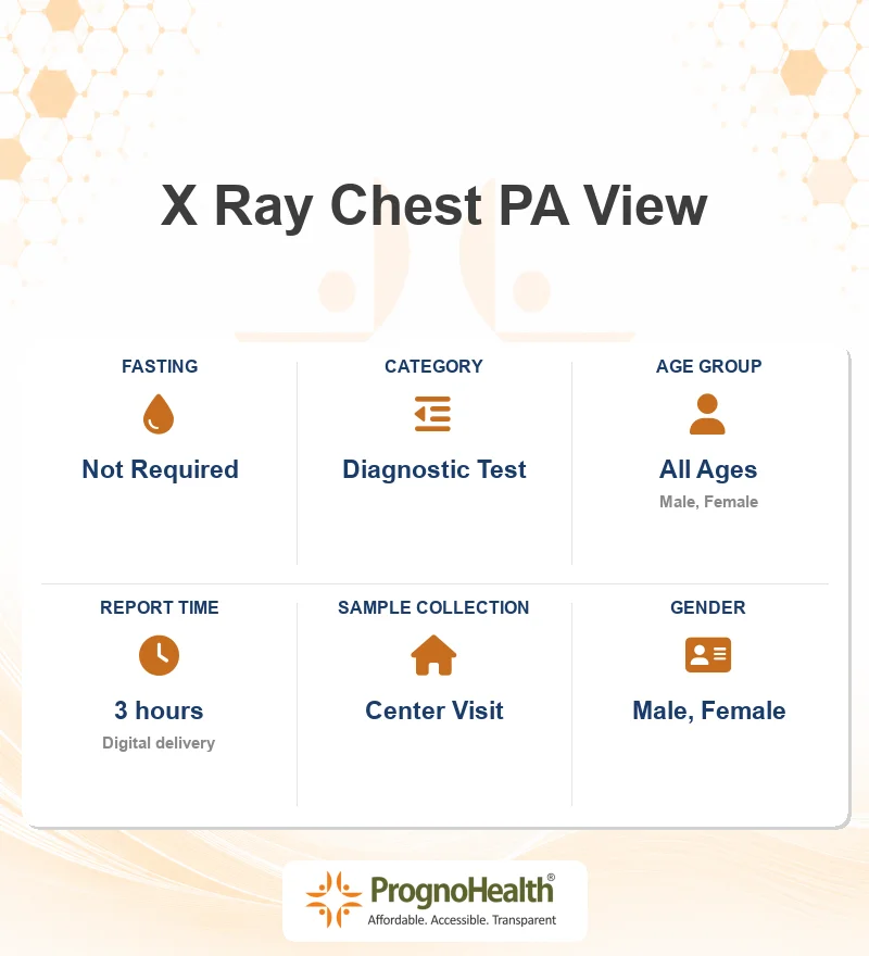 X Ray Chest PA View