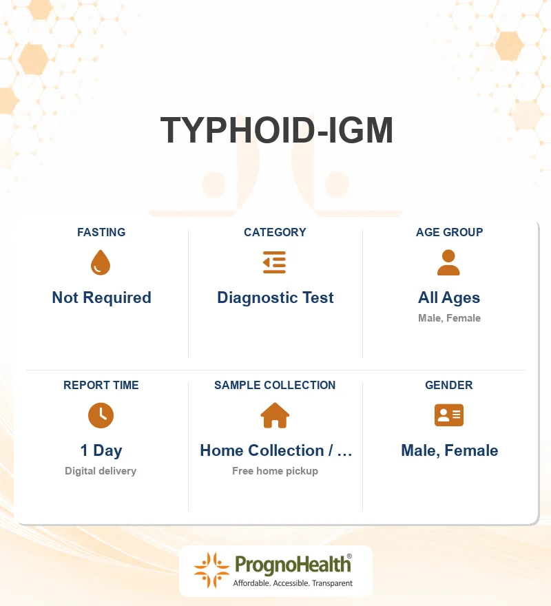 TYPHOID-IGM