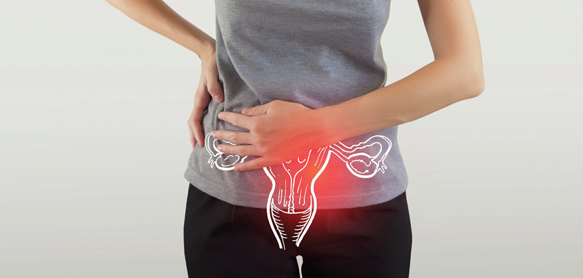 PCOS: Causes, Symptoms, Prevention, and Treatment