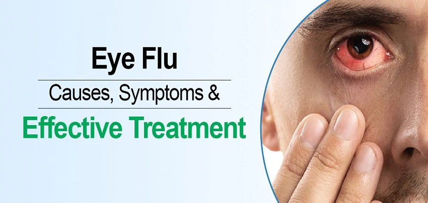 Eye Flu: Causes, Symptoms, Prevention, and Treatment