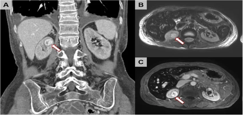 MRI of the abdomen
