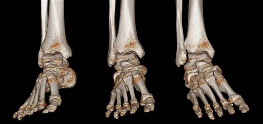 3D CT scan