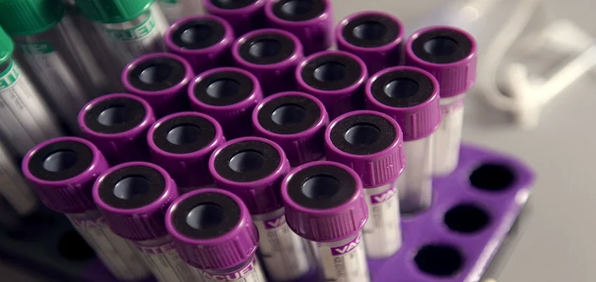 Cholinesterase Test