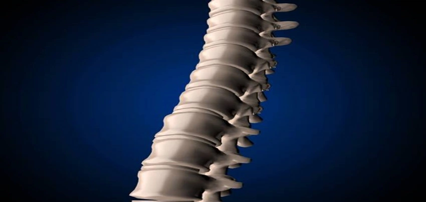 CT scan spiral cervical spine