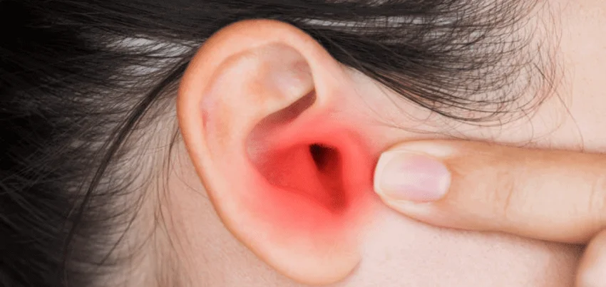 Otitis media