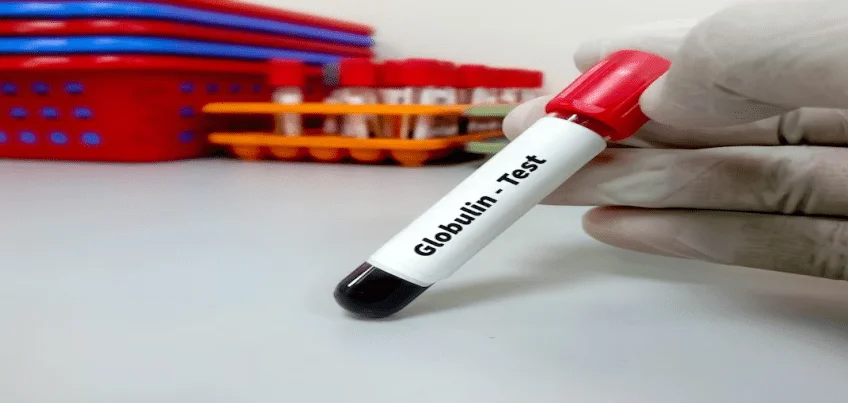 Globulin test