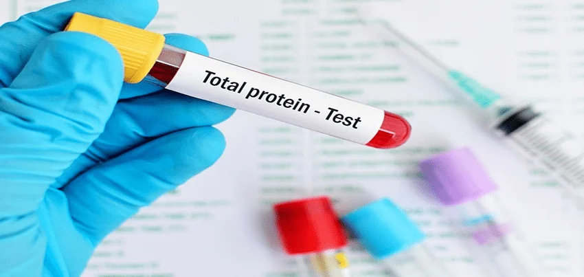Total protein Test