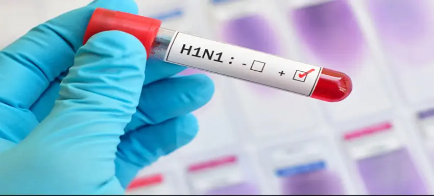 Swine flu – H1N1v