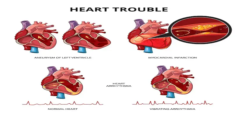 Myocardial