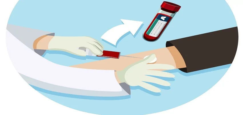 Acid Phosphatase (ACP) test