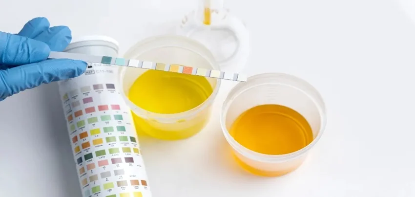 Gram stain Test