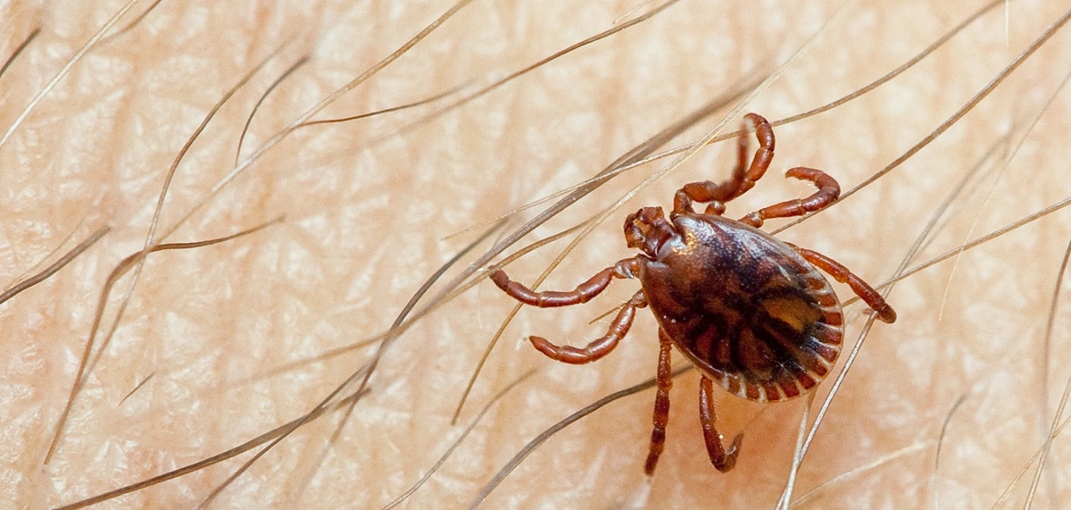 Crimean-Congo Haemorrhagic Fever (CCHF)