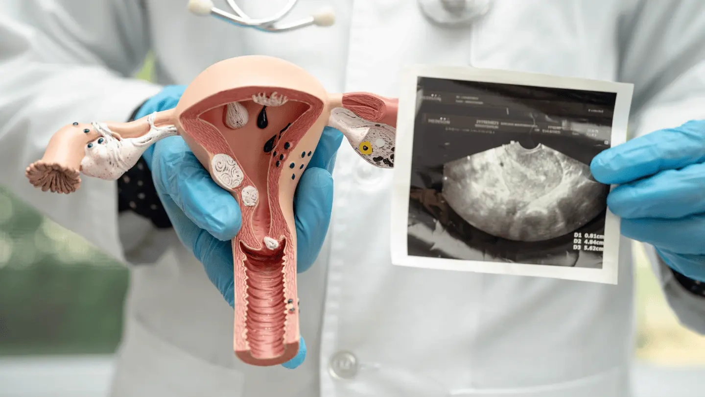 Cervical cancer