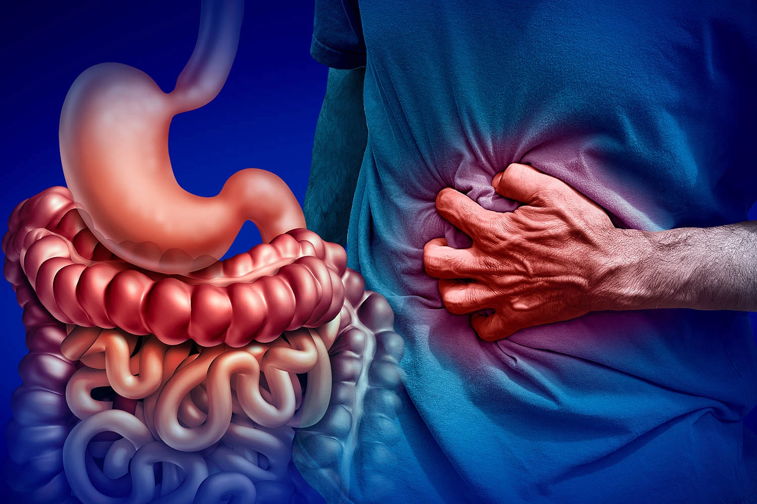 Appendicitis