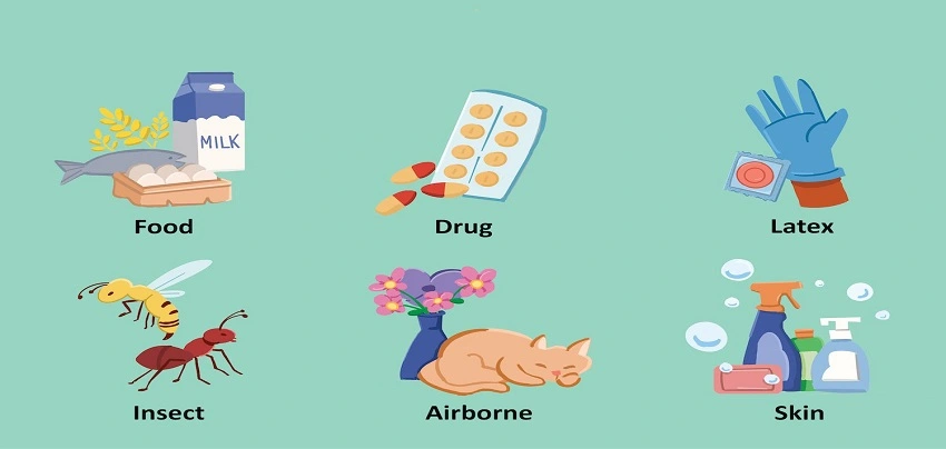 Allergens and Allergies