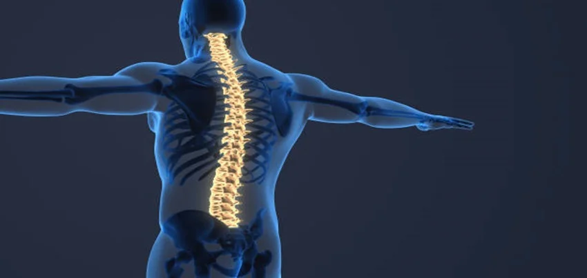 Ankylosing spondylitis (AS)