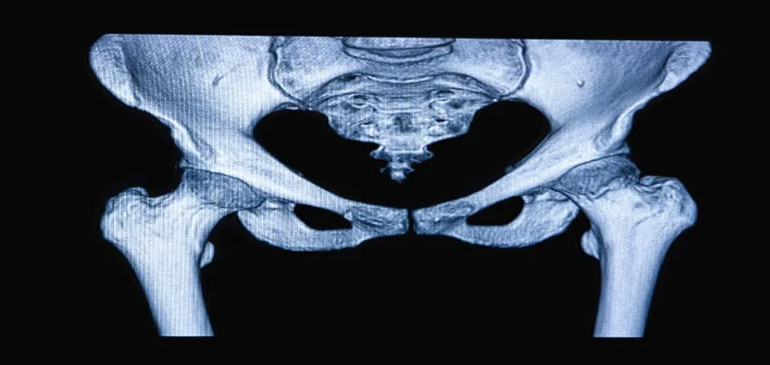 MRI of the pelvis