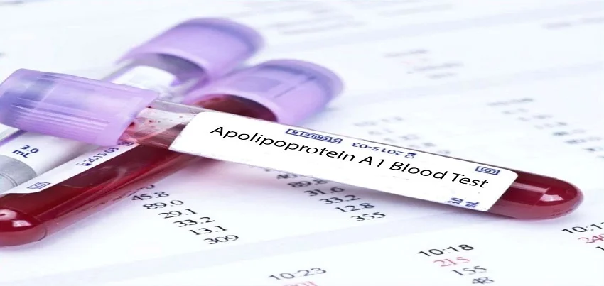 Apolipoprotein A-I (Apo A-I) Test