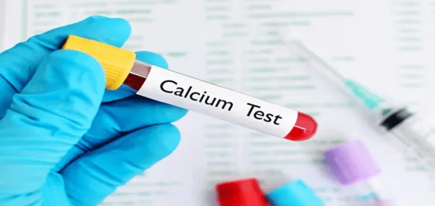 Ionic Calcium Test