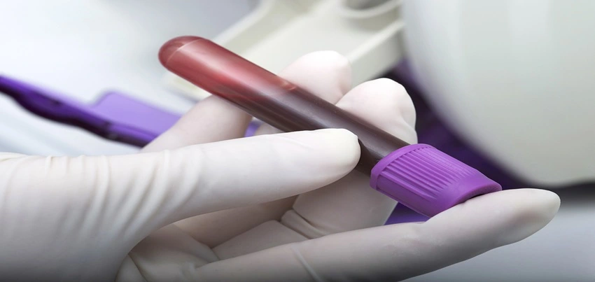 Blood urea Test