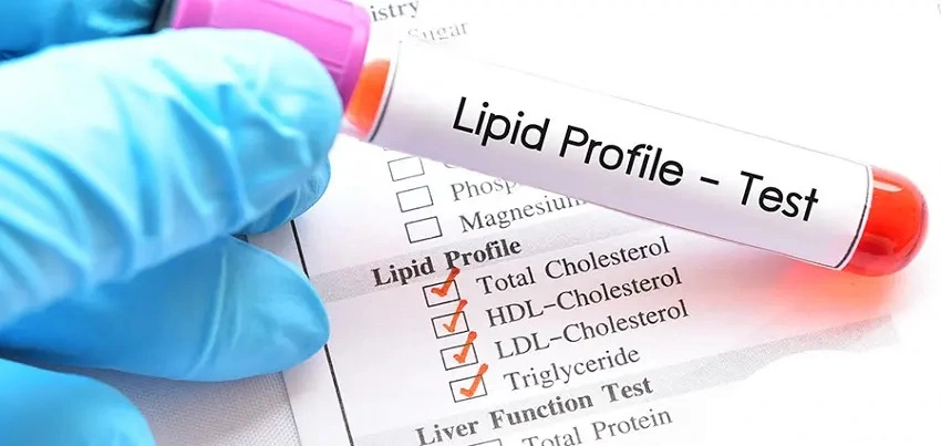 Lipid profile Test