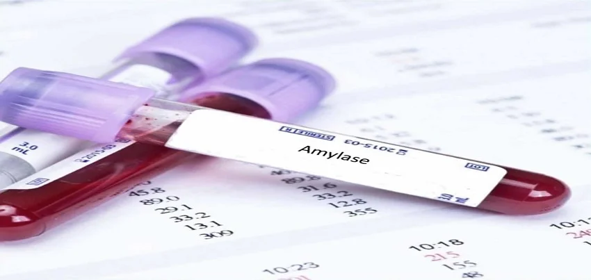 Amylase Test