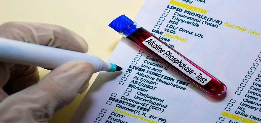 Alkaline Phosphatase (ALP) Test