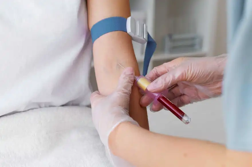 Bleeding Time (BT) and Clotting Time (CT) Test