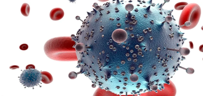 Acquired Immuno Deficiency Syndrome ( AIDS) 