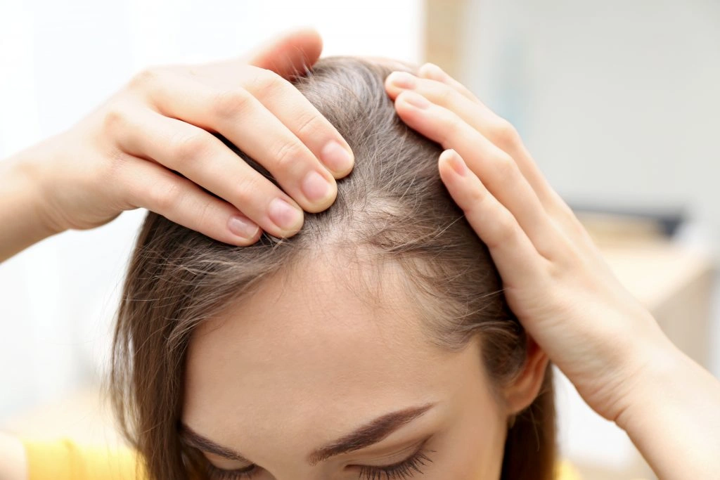 Alopecia (hair loss)