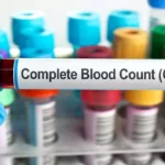 Complete Blood Count (CBC) Test