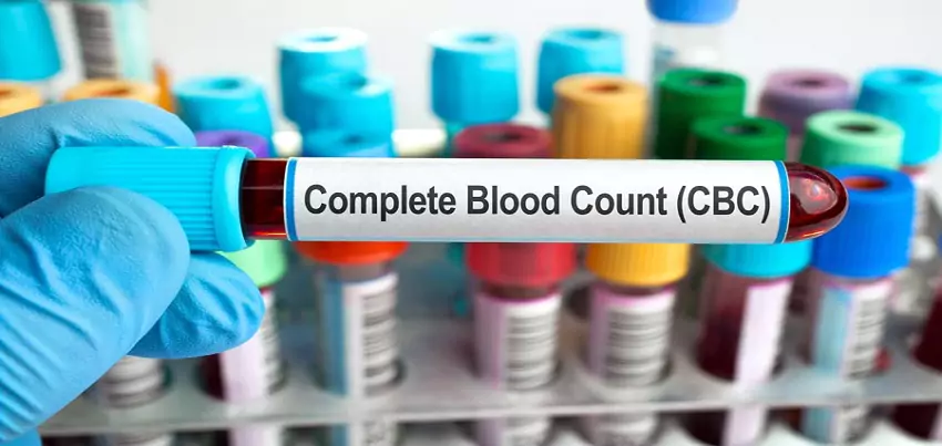 Complete Blood Count (CBC) Test