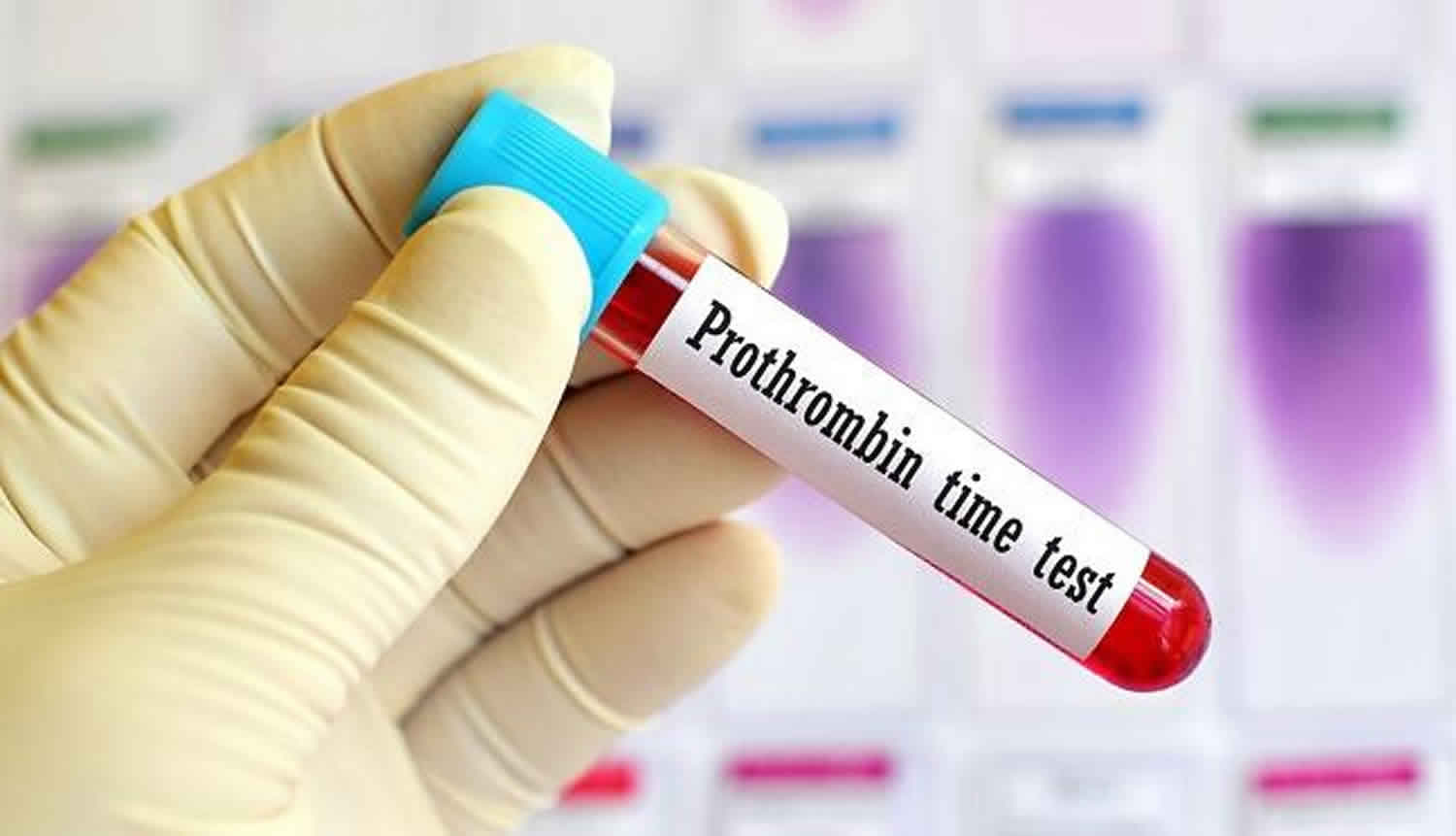 Understanding Prothrombin Time PT Test For Accurate Clotting Assessment