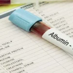 Albumin Test