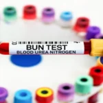 Blood Urea Nitrogen (BUN) Test