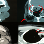 CT scan of the brain plain and orbit Test