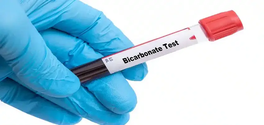 Bicarbonate test