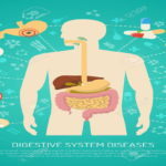 Inflammatory Bowel Disease (IBD)