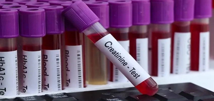 Creatinine Test