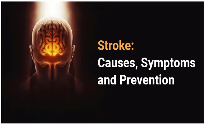 Stroke – Causes, Symptoms& Prevention.