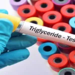 Triglycerides Test