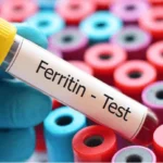 Ferritin Test