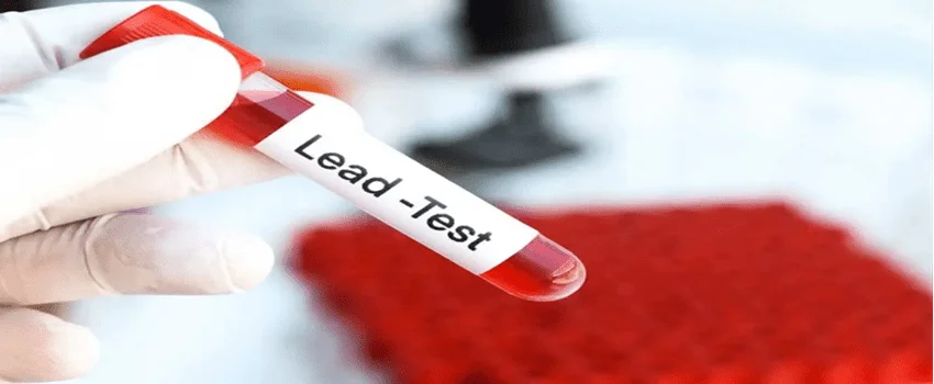 Lead Level Test