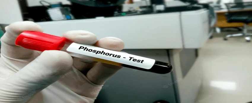 Phosphorus Test