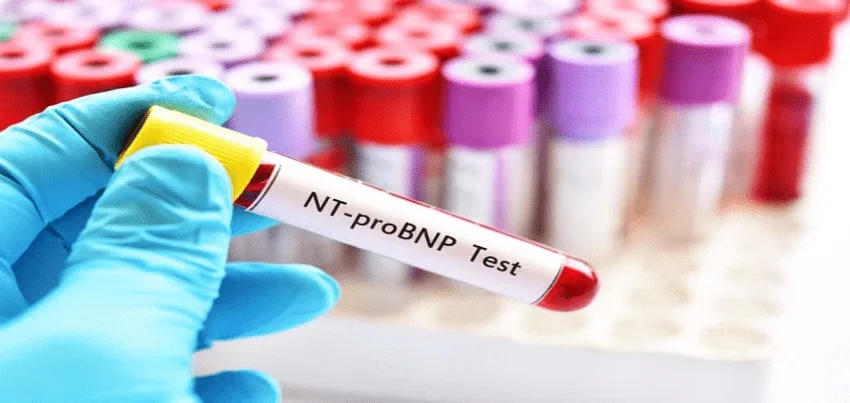 Pro B-type natriuretic peptide (proBNP) Test