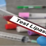 Lipase Test