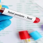 total protein test