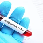 Apolipoprotein B (Apo B) Test