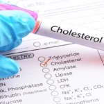 Cholesterol (Total) Test